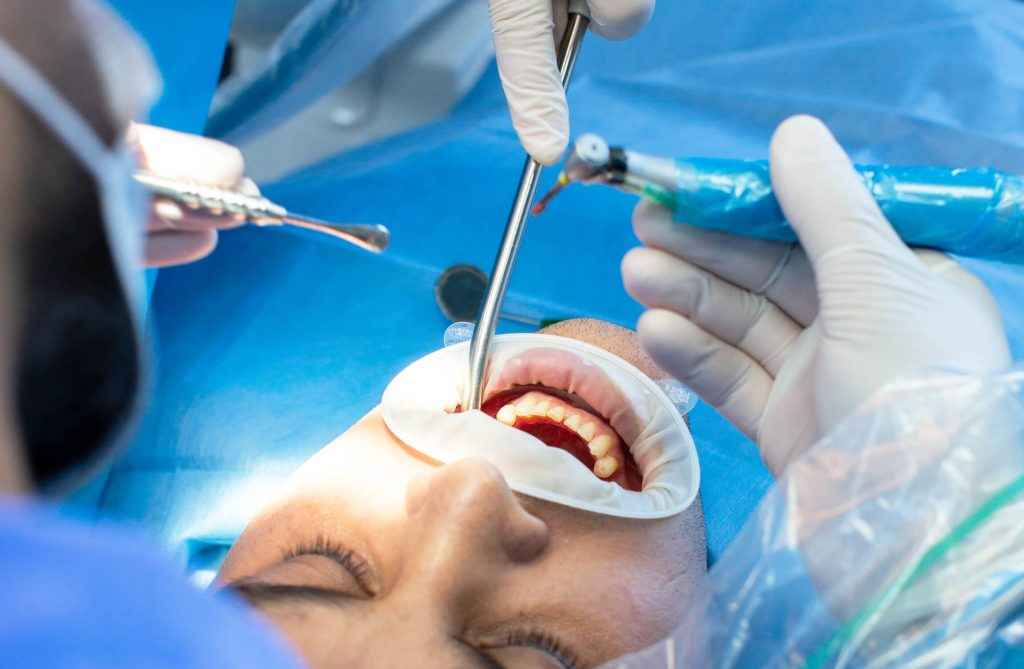 Chirurgie dentaire-dr jamila-zemrani-temara