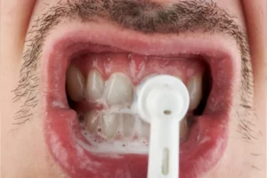 polissage-ou-blanchiment-dentaire-dentiste-temara